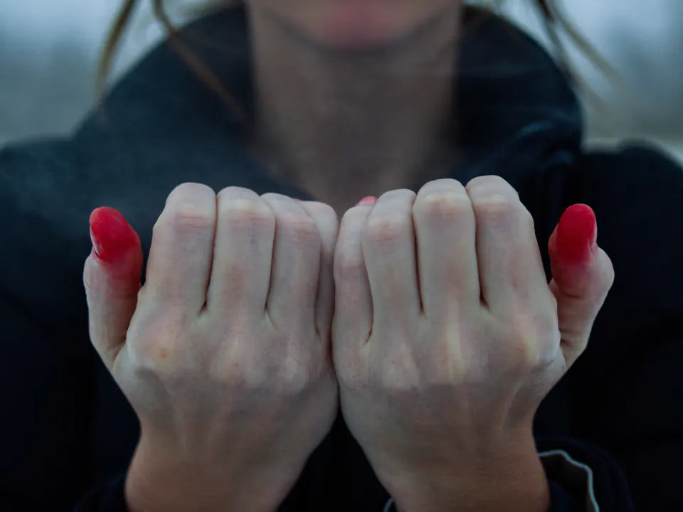 Bare hands blotchy white and red from the cold